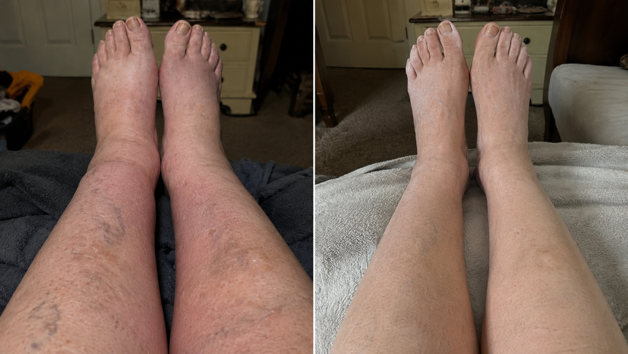 Before and after